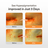 Glutathiosome Dark Spot Serum Vita Drop (50ml)